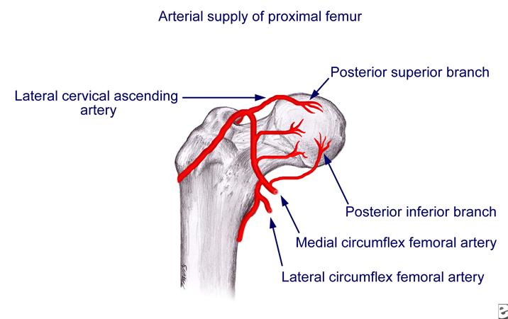 Proximal Femur Fractures Pediatric Pediatrics